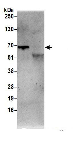 Immunoprecipitation:CPNE3 AntibodyNBP3-29954] -Detection of human CPNE3 by western blot of immunoprecipitates. Samples: Whole cell lysate (0.5 or 1.0 mg per IP reaction; 20% of IP loaded) from 293T cells prepared using NETN lysis buffer. Antibodies: Affinity purified rabbit anti-CPNE3 antibody NBP3-29954 (lot NBP3-29954-1) used for IP at 6 µg per reaction. For blotting immunoprecipitated CPNE3, NBP3-29954 was used at 1 µg/ml. Detection: Chemiluminescence with an exposure time of 3 minutes.