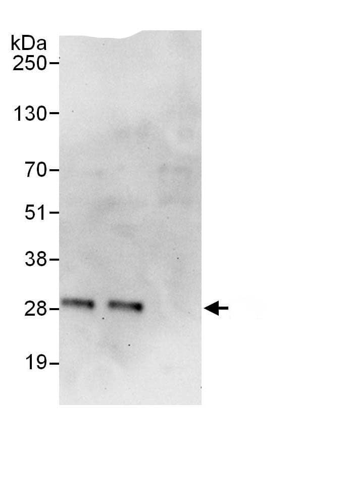 Immunoprecipitation:Exosome component 4 AntibodyNBP3-29955] -Detection of human EXOSC4 by western blot of immunoprecipitates. Samples: Whole cell lysate (1 mg for IP, 20% of IP loaded) from HeLa cells. Antibodies: Affinity purified rabbit anti-EXOSC4 antibody NBP3-29955 used for IP at 6 µg/mg lysate. EXOSC4 was also immunoprecipitated by rabbit anti-EXOSC4., which recognizes an upstream epitope. For blotting immunoprecipitated EXOSC4, A303-774A was used at 1 µg/ml. Detection: Chemiluminescence with an exposure time of 30 seconds.