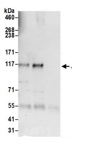 Immunoprecipitation:FGD1 AntibodyNBP3-29957] -Detection of human FGD1 by western blot of immunoprecipitates. Samples: Whole cell lysate (0.5 or 1.0 mg per IP reaction; 20% of IP loaded) from HeLa cells prepared using NETN lysis buffer. Antibodies: Affinity purified rabbit anti-FGD1 antibody NBP3-29957 (lot NBP3-29957-1) used for IP at 6 µg per reaction. FGD1 was also immunoprecipitated by rabbit anti-FGD1 antibody BL20516. For blotting immunoprecipitated FGD1, NBP3-29957 was used at 1 µg/ml. Detection: Chemiluminescence with an exposure time of 30 seconds.