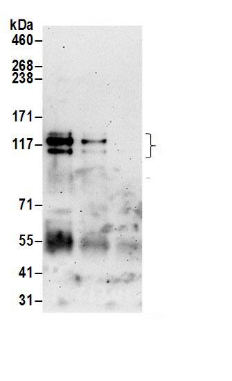 Immunoprecipitation:CLCN7 AntibodyNBP3-29958] -Detection of human CLCN7 by western blot of immunoprecipitates. Samples: Whole cell lysate (0.5 or 1.0 mg per IP reaction; 20% of IP loaded) from Jurkat cells prepared using NETN lysis buffer. Antibodies: Affinity purified rabbit anti-CLCN7 antibody NBP3-29958 (lot NBP3-29958-1) used for IP at 6 µg per reaction. CLCN7 was also immunoprecipitated by rabbit anti-CLCN7 antibody BL21349. For blotting immunoprecipitated CLCN7, NBP3-29958 was used at 0.4 µg/ml. Detection: Chemiluminescence with an exposure time of 3 minutes.