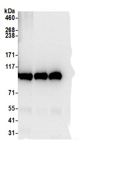 Immunoprecipitation:MTHFD1 AntibodyNBP3-29959] -Detection of human MTHFD1 by western blot of immunoprecipitates. Samples: Whole cell lysate (0.5 or 1.0 mg per IP reaction; 20% of IP loaded) from 293T cells prepared using NETN lysis buffer. Antibodies: Affinity purified rabbit anti-MTHFD1 antibody NBP3-29959 (lot NBP3-29959-1) used for IP at 6 µg per reaction. MTHFD1 was also immunoprecipitated by rabbit anti-MTHFD1 antibodies for blotting immunoprecipitated MTHFD1, NBP3-29959 was used at 1 µg/ml. Detection: Chemiluminescence with an exposure time of 10 seconds.