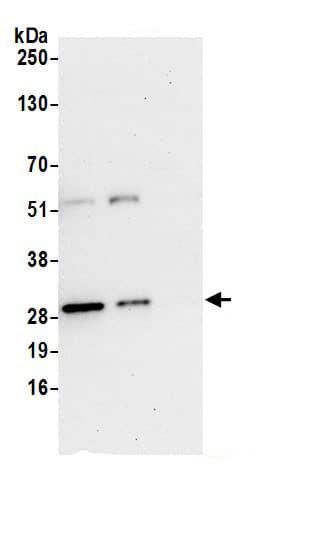 Immunoprecipitation:Peroxiredoxin 6 AntibodyNBP3-29960] -Detection of human PRDX6 by western blot of immunoprecipitates. Samples: Whole cell lysate (0.5 or 1.0 mg per IP reaction; 20% of IP loaded) from 293T cells prepared using NETN lysis buffer. Antibodies: Affinity purified rabbit anti-PRDX6 antibody NBP3-29960 (lot NBP3-29960-1) used for IP at 6 µg per reaction. PRDX6 was also immunoprecipitated by rabbit anti-PRDX6.. For blotting immunoprecipitated PRDX6, NBP3-29960 was used at 1 µg/ml. Detection: Chemiluminescence with an exposure time of 30 seconds.