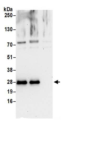 Immunoprecipitation:HN1L AntibodyNBP3-29962] -Detection of human HN1L by western blot of immunoprecipitates. Samples: Whole cell lysate (0.5 or 1.0 mg per IP reaction; 20% of IP loaded) from 293T cells prepared using NETN lysis buffer. Antibodies: Affinity purified rabbit anti-HN1L antibody NBP3-29962 (lot NBP3-29962-1) used for IP at 6 µg per reaction. HN1L was also immunoprecipitated by rabbit anti-HN1L.. For blotting immunoprecipitated HN1L, NBP3-29962 was used at 0.4 µg/ml. Detection: Chemiluminescence with an exposure time of 30 seconds.