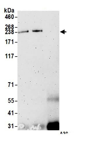 Immunoprecipitation:CNOT1 AntibodyNBP3-29963] -Detection of human CNOT1 by western blot of immunoprecipitates. Samples: Whole cell lysate (1.0 mg per IP reaction; 20% of IP loaded) from HeLa cells prepared using NETN lysis buffer. Antibodies: Affinity purified Rabbit anti-CNOT1 antibody NBP3-29963 (lot NBP3-29963-2) used for IP at 100 µl per reaction. CNOT1 was also immunoprecipitated by a previous lot of this antibody (lot NBP3-29963). For blotting immunoprecipitated CNOT1, NBP3-29963 was used at 1:1000. Detection: Chemiluminescence with an exposure time of 3 minutes.