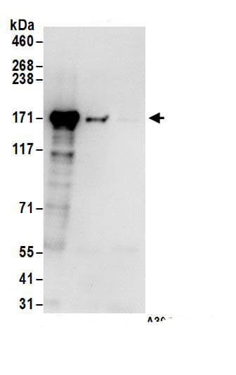 Immunoprecipitation:HDLBP AntibodyNBP3-29965] -Detection of human Vigilin by western blot of immunoprecipitates. Samples: Whole cell lysate (1 mg for IP; 20% of IP loaded) from HEK293T cells. Antibodies: Affinity purified rabbit anti-Vigilin antibody NBP3-29965 (lot NBP3-29965-1) used for IP at 6 µg/mg lysate. Vigilin was also immunoprecipitated by rabbit anti-Vigilin antibody BL14298. For blotting immunoprecipitated Vigilin, NBP3-29965 was used at 1 µg/ml. Detection: Chemiluminescence with an exposure time of 10 seconds.