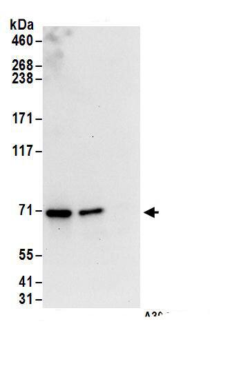 Immunoprecipitation:Nucleoporin NUP85 AntibodyNBP3-29966] -Detection of human NUP85 by western blot of immunoprecipitates. Samples: Whole cell lysate (1 mg for IP; 20% of IP loaded) from HEK293T cells. Antibodies: Affinity purified rabbit anti-NUP85 antibody NBP3-29966 (lot NBP3-29966-1) used for IP at 6 µg/mg lysate. NUP85 was also immunoprecipitated by rabbit anti-NUP85.. For blotting immunoprecipitated NUP85, NBP3-29966 was used at 1 µg/ml. Detection: Chemiluminescence with an exposure time of 10 seconds.