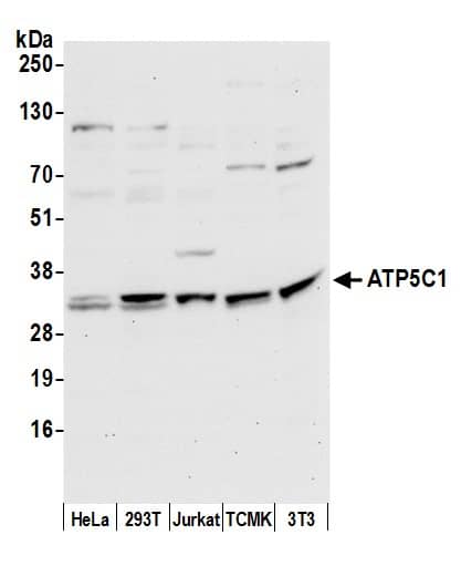 Western Blot:[NBP3-29969]-Detection of human and mouse ATP5C1 by western blot. Samples: Whole cell lysate from HeLa, HEK293T, Jurkat, mouse TCMK-1, and mouse NIH 3T3 cells prepared using NETN lysis buffer. Antibody: Affinity purified rabbit anti-ATP5C1 antibody used for WB at 0. 1 µg/ml. Detection: Chemiluminescence with an exposure time of 30 seconds.