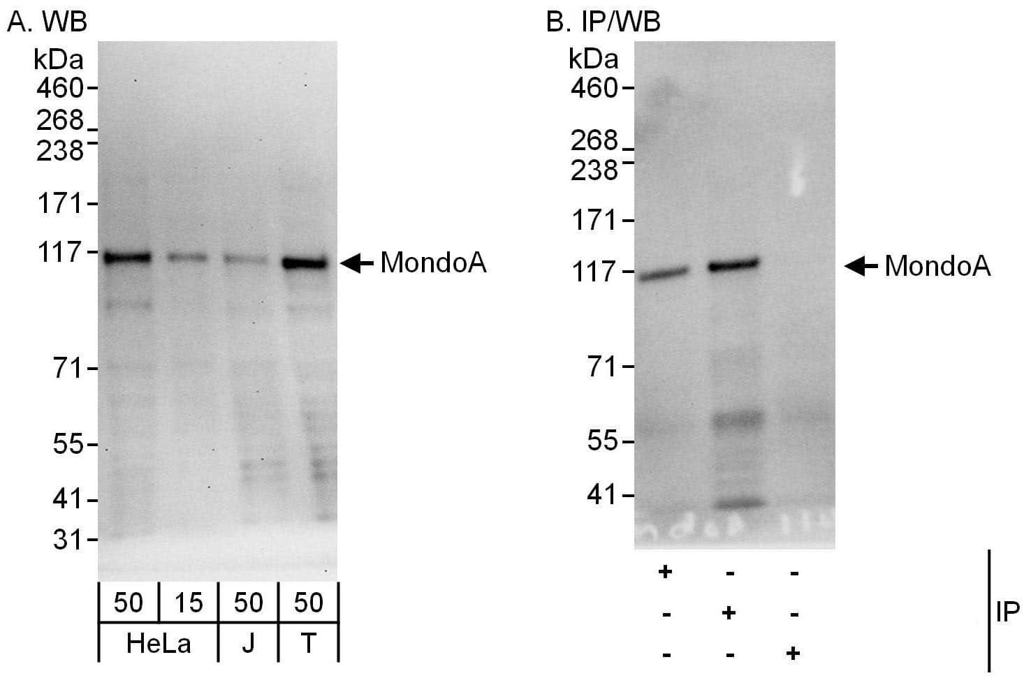 Western Blot:[NBP3-29971]-Detection of human MondoA by western blot and immunoprecipitation. Samples: Whole cell lysate from HeLa , Jurkat and HEK293T cells. Antibodies: Affinity purified rabbit antibody used for WB at 0. 04 µg/ml and 0. 4 µg/ml and used for IP at 6 µg/mg lysate. MondoA was also immunoprecipitated by rabbit antibody , which recognizes an upstream epitope. Detection: Chemiluminescence with exposure times of 30 seconds and 3 seconds.