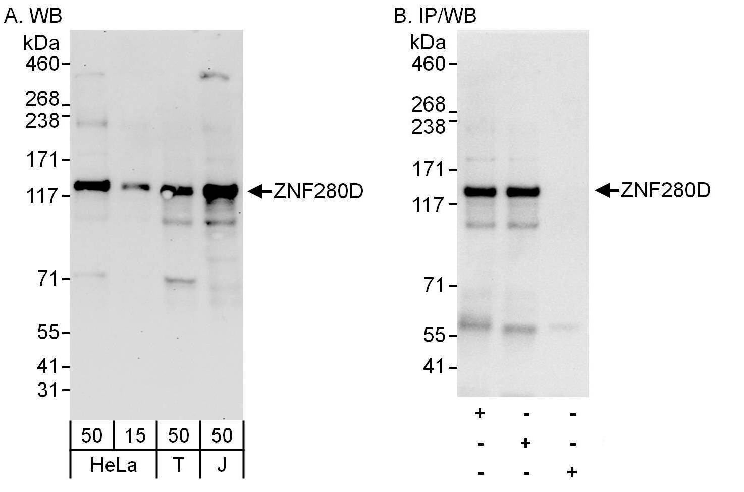 Western Blot:[NBP3-29972]-Detection of human ZNF280D by western blot and immunoprecipitation. Samples: Whole cell lysate from HeLa , HEK293T and Jurkat cells. Antibodies: Affinity purified rabbit anti-ZNF280D antibody used for WB at 0. 4 µg/ml and 1 µg/ml and used for IP at 6 µg/mg lysate. ZNF280D was also immunoprecipitated by rabbit anti-ZNF280D antibody , which recognizes a downstream epitope. Detection: Chemiluminescence with exposure times of 30 seconds and 10 seconds.