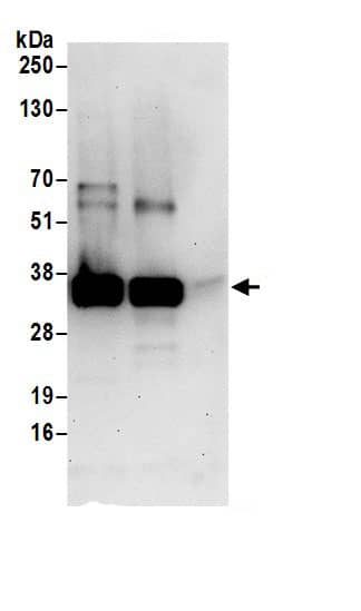 Immunoprecipitation:CLNS1A AntibodyNBP3-29974] -Detection of human ICLN by western blot of immunoprecipitates. Samples: Whole cell lysate (0.5 or 1.0 mg per IP reaction; 20% of IP loaded) from 293T cells prepared using NETN lysis buffer. Antibodies: Affinity purified rabbit anti-ICLN antibody NBP3-29974 (lot NBP3-29974-1) used for IP at 6 µg per reaction. ICLN was also immunoprecipitated by rabbit anti-ICLN antibody BL17109. For blotting immunoprecipitated ICLN, NBP3-29974 was used at 1 µg/ml. Detection: Chemiluminescence with an exposure time of 30 seconds.