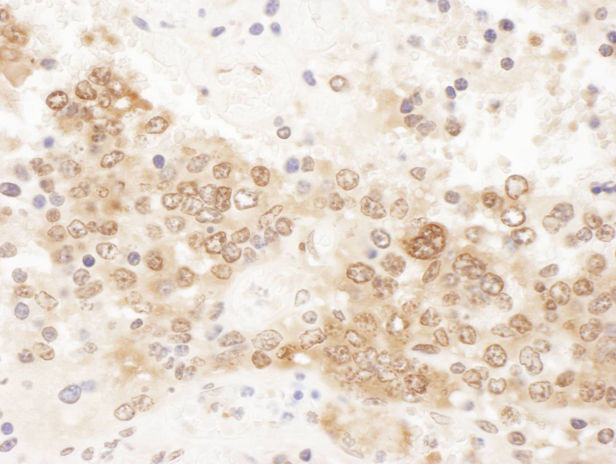 Immunohistochemistry;CLNS1A Antibody[NBP3-29830]Detection of mouse ICLN by immunohistochemistry. Sample: FFPE section of mouse teratoma. Antibody: Affinity purified rabbit anti-ICLN  used at a dilution of 1:1,000 . Detection: DAB