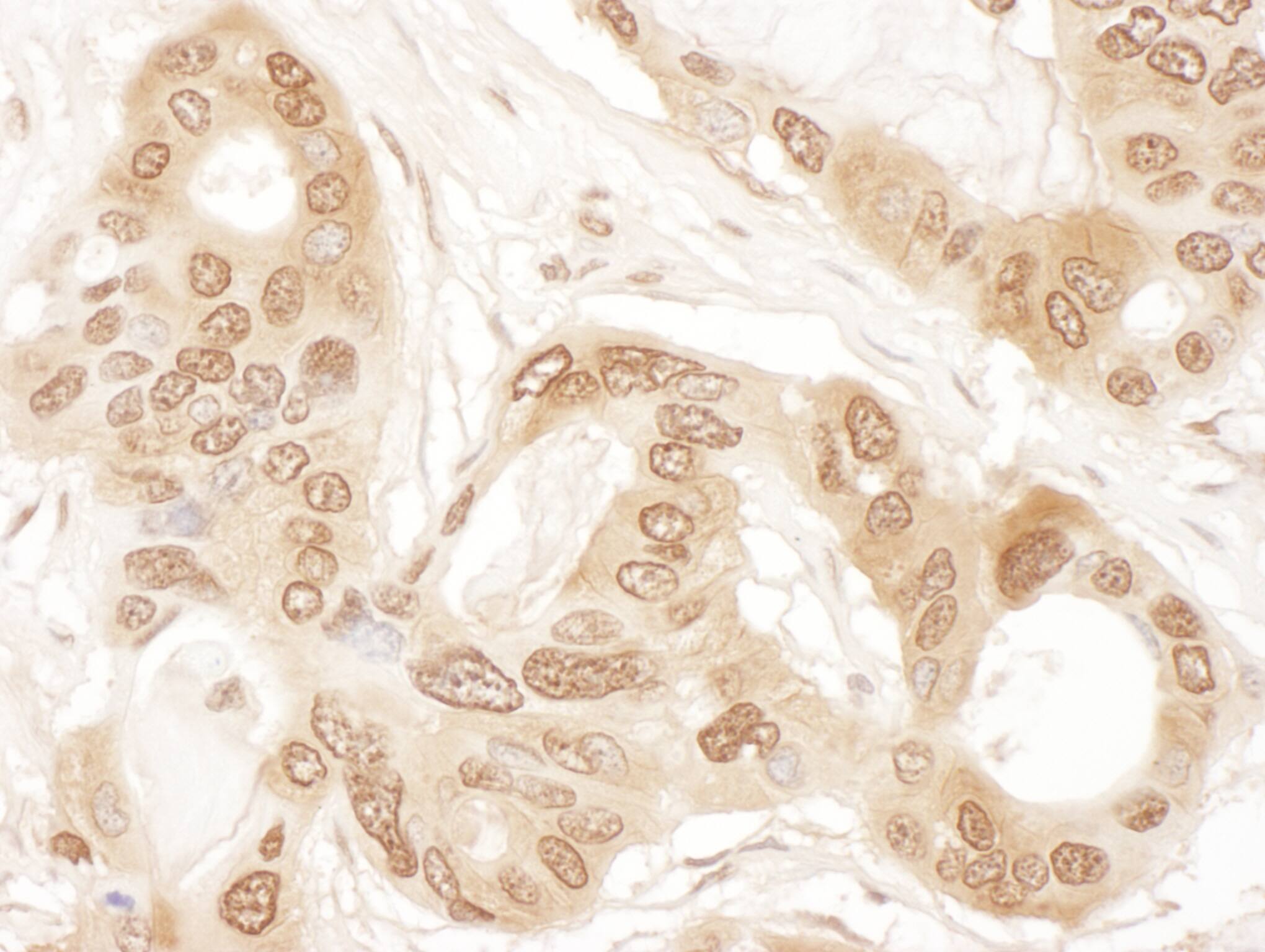 Immunohistochemistry CLNS1A Antibody