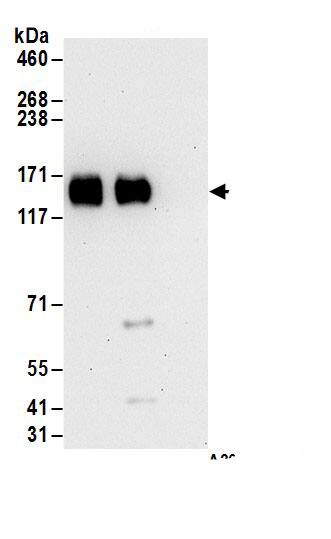 Immunoprecipitation:ZNF828 AntibodyNBP3-29975] -Detection of human CHAMP1 by western blot of immunoprecipitates. Samples: Whole cell lysate (1 mg for IP; 20% of IP loaded) from 293T cells. Antibodies: Affinity purified rabbit anti-CHAMP1 antibody NBP3-29975 (lot NBP3-29975-1) used for IP at 6 µg/mg lysate. CHAMP1 was also immunoprecipitated by rabbit anti-CHAMP1.. For blotting immunoprecipitated CHAMP1, NBP3-29975 was used at 1 µg/ml. Detection: Chemiluminescence with an exposure time of 30 seconds.