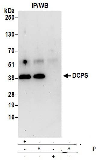 Immunoprecipitation:[NBP3-29978]-Detection of human DCPS by western blot of immunoprecipitates. Samples: Whole cell lysate from 293T cells prepared using NETN lysis buffer. Antibodies: Affinity purified rabbit anti-DCPS antibody used for IP at 6 µg per reaction. DCPS was also immunoprecipitated by rabbit anti-DCPS antibody. For blotting immunoprecipitated DCPS, was used at 1 µg/ml. Detection: Chemiluminescence with an exposure time of 30 seconds.