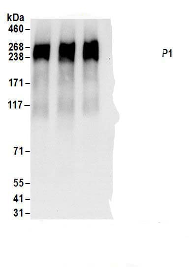 Immunoprecipitation:RRBP1 AntibodyNBP3-29979] -Detection of human RRBP1 by western blot of immunoprecipitates. Samples: Whole cell lysate (1 mg for IP; 20% of IP loaded) from HeLa cells. Antibodies: Affinity purified rabbit anti-RRBP1 antibody NBP3-29979 (lot NBP3-29979-1) used for IP at 6 µg/mg lysate. RRBP1 was also immunoprecipitated by rabbit anti-RRBP1 antibodies. For blotting immunoprecipitated RRBP1, NBP3-29979 was used at 1 µg/ml. Detection: Chemiluminescence with an exposure time of 10 seconds.