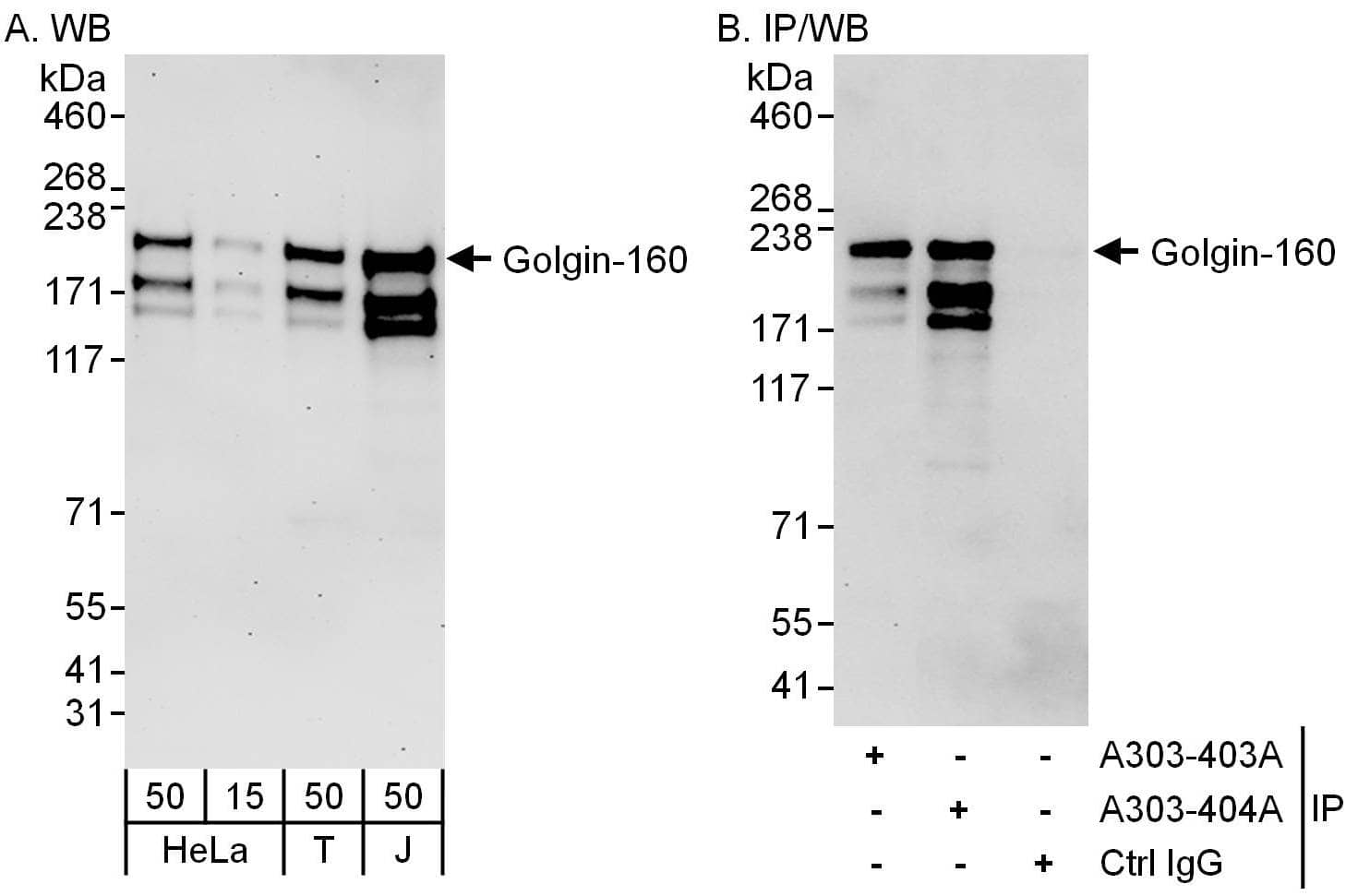 Western Blot:[NBP3-29981]-Detection of human Golgin-160 by western blot and immunoprecipitation. Samples: Whole cell lysate from HeLa , HEK293T and Jurkat cells. Antibodies: Affinity purified rabbit anti-Golgin-160 antibody used for WB at 0. 1 µg/ml and 1 µg/ml and used for IP at 6 µg/mg lysate. Golgin-160 was also immunoprecipitated by rabbit anti-Golgin-160 antibody , which recognizes an upstream epitope. Detection: Chemiluminescence with exposure times of 3 minutes and 30 seconds.
