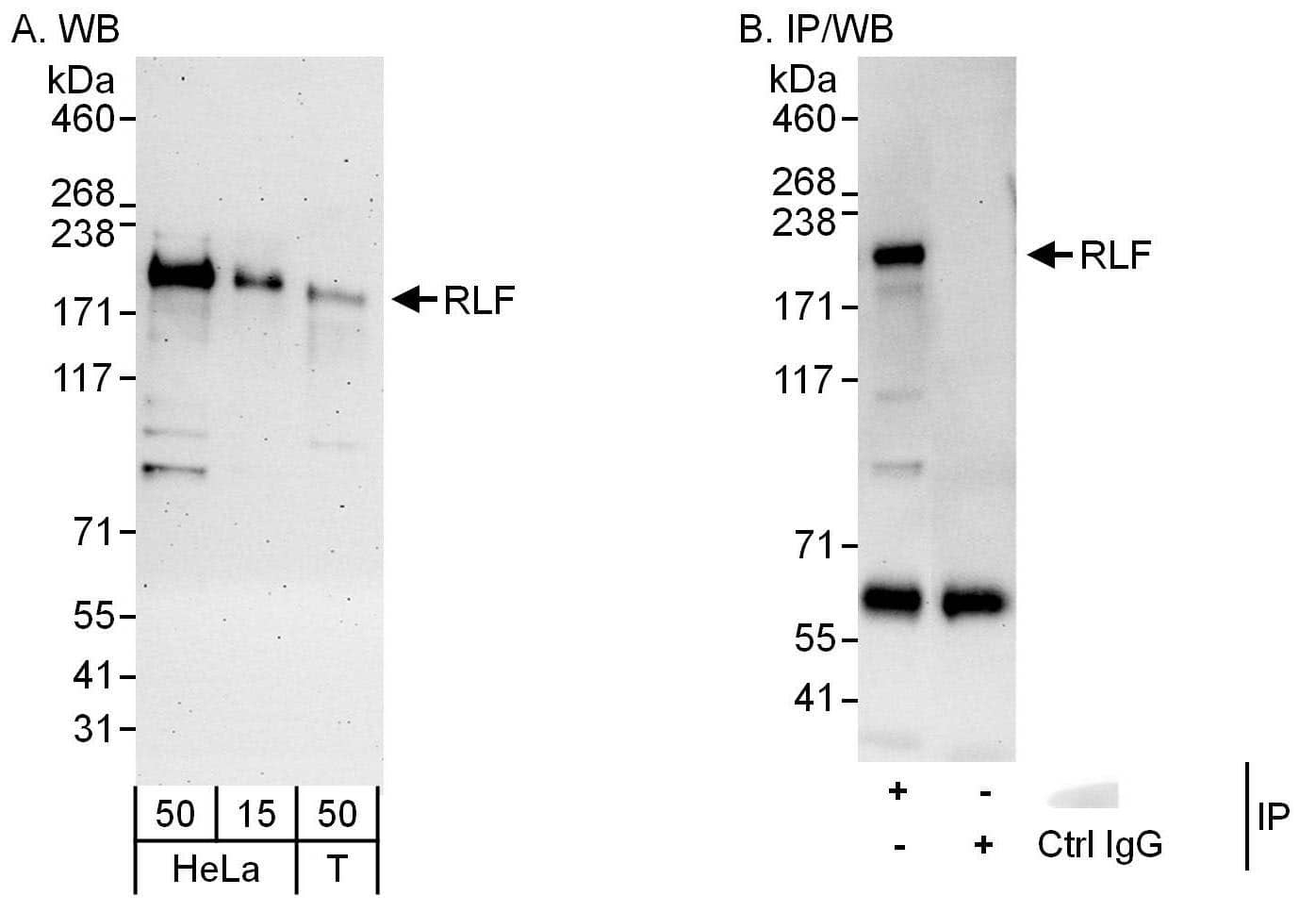 Western Blot RLF Antibody