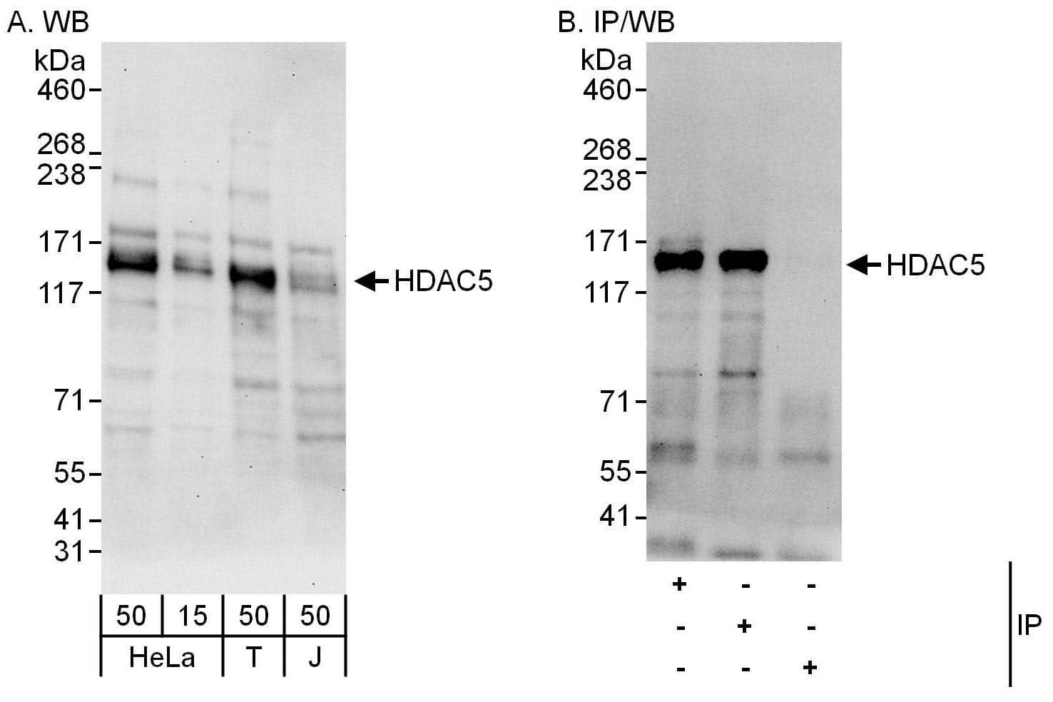 Western Blot:[NBP3-29985]-Detection of human HDAC5 by western blot and immunoprecipitation. Samples: Whole cell lysate from HeLa , HEK293T and Jurkat cells. Antibodies: Affinity purified rabbit anti-HDAC5 antibody used for WB at 0. 04 µg/ml and 0. 4 µg/ml and used for IP at 6 µg/mg lysate. HDAC5 was also immunoprecipitated by rabbit anti-HDAC5 antibody , which recognizes a downstream epitope. Detection: Chemiluminescence with exposure times of 3 minutes and 30 seconds.