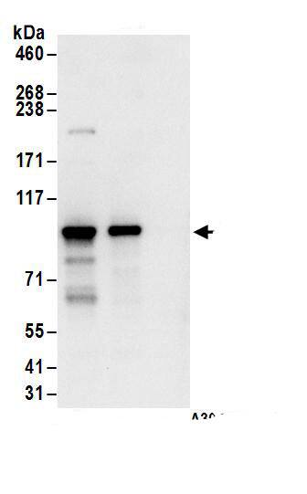 Immunoprecipitation:ASCC2 AntibodyNBP3-29986] -Detection of human ASCC2 by western blot of immunoprecipitates. Samples: Whole cell lysate (1 mg for IP; 20% of IP loaded) from HeLa cells. Antibodies: Affinity purified rabbit anti-ASCC2 antibody NBP3-29986 (lot NBP3-29986-1) used for IP at 6 µg/mg lysate. ASCC2 was also immunoprecipitated by rabbit anti-ASCC2.. For blotting immunoprecipitated ASCC2, NBP3-29986 was used at 1 µg/ml. Detection: Chemiluminescence with an exposure time of 10 seconds.