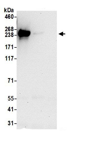 Immunoprecipitation:DIP2B AntibodyNBP3-29987] -Detection of human DIP2B by western blot of immunoprecipitates. Samples: Whole cell lysate (0.5 or 1.0 mg per IP reaction; 20% of IP loaded) from Jurkat cells prepared using NETN lysis buffer. Antibodies: Affinity purified rabbit anti-DIP2B antibody NBP3-29987 (lot NBP3-29987-1) used for IP at 6 µg per reaction. DIP2B was also immunoprecipitated by rabbit anti-DIP2B antibody BL17683. For blotting immunoprecipitated DIP2B, NBP3-29987 was used at 0.4 µg/ml. Detection: Chemiluminescence with an exposure time of 30 seconds.