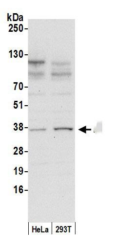 Western Blot:[NBP3-29991]-Detection of human DDAH1 by western blot. Samples: Whole cell lysate from HeLa and 293T cells prepared using NETN lysis buffer. Antibody: Affinity purified rabbit anti-DDAH1 antibody used for WB at 0. 4 µg/ml. Detection: Chemiluminescence with an exposure time of 30 seconds.