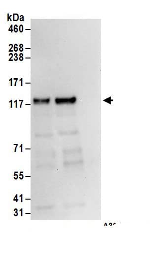 Immunoprecipitation:ROR2 AntibodyNBP3-29993] -Detection of human ROR2 by western blot of immunoprecipitates. Samples: Whole cell lysate (1 mg for IP; 20% of IP loaded) from 293T cells. Antibodies: Affinity purified rabbit anti-ROR2 antibody NBP3-29993 (lot NBP3-29993-1) used for IP at 6 µg/mg lysate. ROR2 was also immunoprecipitated by rabbit anti-ROR2.. For blotting immunoprecipitated ROR2, NBP3-29993 was used at 1 µg/ml. Detection: Chemiluminescence with an exposure time of 10 seconds.