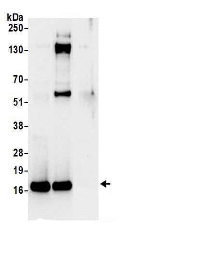 Immunoprecipitation:60S ribosomal protein L23 AntibodyNBP3-29994] -Detection of human Ribosomal Protein L23 by western blot of immunoprecipitates. Samples: Whole cell lysate (0.5 or 1.0 mg per IP reaction; 20% of IP loaded) from 293T cells prepared using NETN lysis buffer. Antibodies: Affinity purified rabbit anti-Ribosomal Protein L23 antibody NBP3-29994 (lot NBP3-29994-1) used for IP at 6 µg per reaction. Ribosomal Protein L23 was also immunoprecipitated by rabbit anti-Ribosomal Protein L23.. For blotting immunoprecipitated Ribosomal Protein L23, NBP3-29994 was used at 1 µg/ml. Detection: Chemiluminescence with an exposure time of 10 seconds.