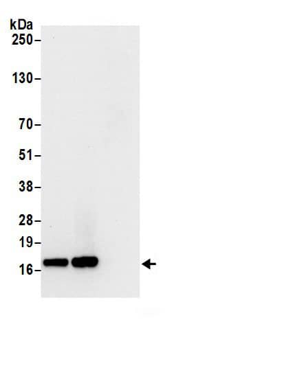 Immunoprecipitation:60S ribosomal protein L23 AntibodyNBP3-29995] -Detection of human Ribosomal Protein L23 by western blot of immunoprecipitates. Samples: Whole cell lysate (0.5 or 1.0 mg per IP reaction; 20% of IP loaded) from 293T cells prepared using NETN lysis buffer. Antibodies: Affinity purified rabbit anti-Ribosomal Protein L23 antibody NBP3-29995 (lot NBP3-29995-1) used for IP at 6 µg per reaction. Ribosomal Protein L23 was also immunoprecipitated by rabbit anti-Ribosomal Protein L23.. For blotting immunoprecipitated Ribosomal Protein L23, NBP3-29995 was used at 1 µg/ml. Detection: Chemiluminescence with an exposure time of 10 second.