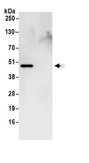 Immunoprecipitation:IDH2 AntibodyNBP3-29996] -Detection of human IDH2 by western blot of immunoprecipitates. Samples: Whole cell lysate (1 mg for IP; 20% of IP loaded) from 293T cells. Antibodies: Affinity purified rabbit anti-IDH2 antibody NBP3-29996 (lot NBP3-29996-1) used for IP at 6 µg/mg lysate. For blotting immunoprecipitated IDH2, NBP3-29996 was used at 1 µg/ml. Detection: Chemiluminescence with an exposure time of 10 seconds.