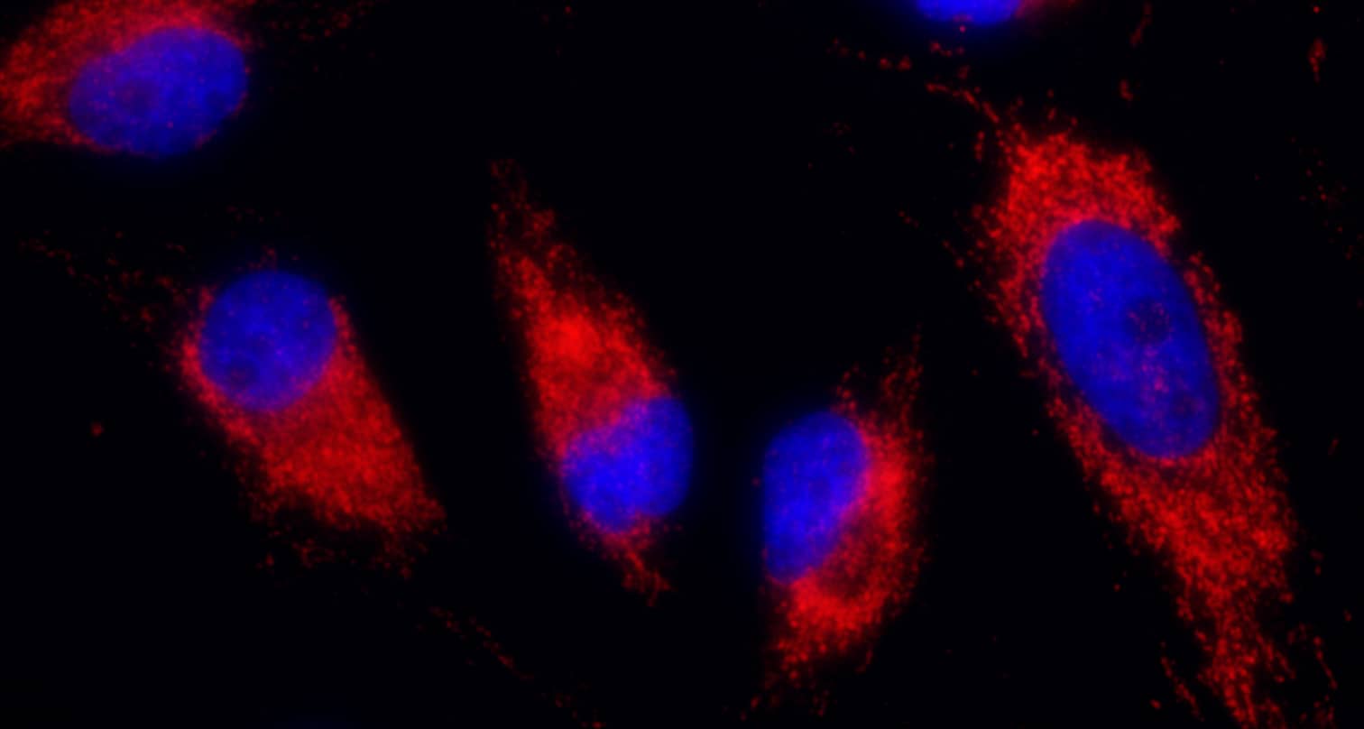 Immunocytochemistry/ Immunofluorescence;IDH2 Antibody[NBP3-29974]Detection of human IDH2 by immunocytochemistry. Sample: Formaldehyde-fixed asynchronous HeLa cells. Antibody: Affinity purified rabbit anti-IDH2  used at a dilution of 1:1,000 . Detection: Red-fluorescent goat anti-rabbit IgG-heavy and light chain cross-adsorbed Antibody DyLight® 594 Conjugated used at a dilution of 1:100.