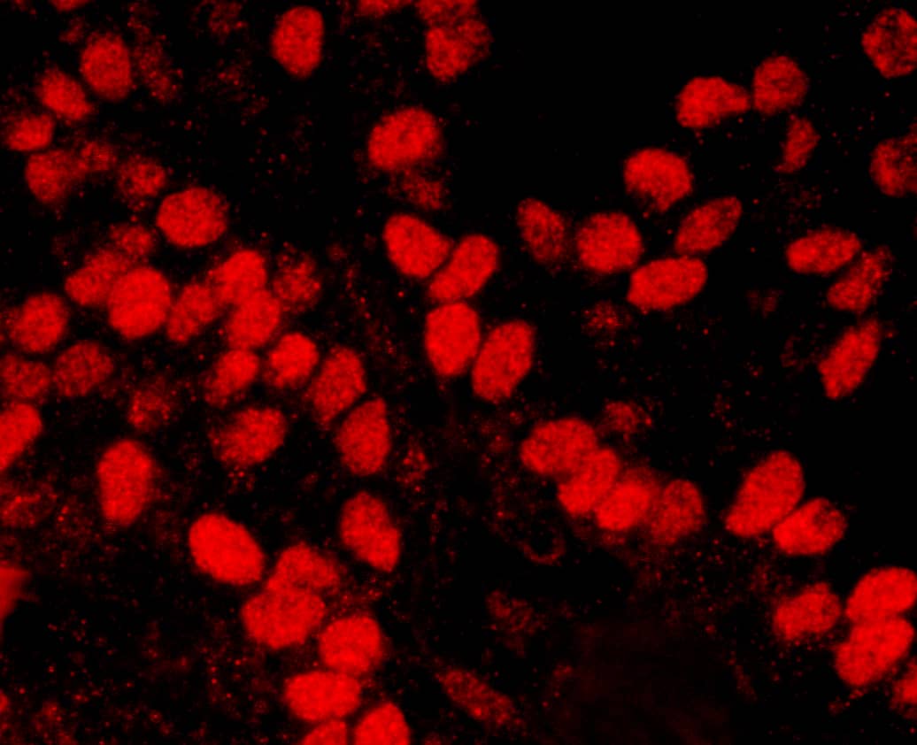 Immunocytochemistry/ Immunofluorescence;HMGN1/HMG14 Antibody[NBP3-30724]Detection of human HMGN1 by immunohistochemistry. Sample: FFPE section of human breast carcinoma. Antibody: Affinity purified rabbit anti-HMGN1  used at a dilution of 1:2,000 . . Detection: Red-fluorescent goat anti-rabbit IgG-heavy and light chain cross-adsorbed Antibody DyLight® 594 Conjugated used at a dilution of 1:100  .