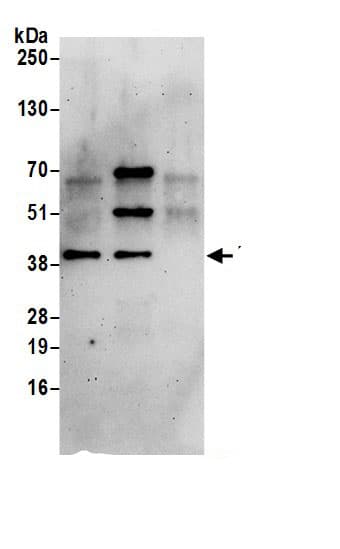 Immunoprecipitation:HSP40/DNAJB1 AntibodyNBP3-29999] -Detection of human DNAJB1 by western blot of immunoprecipitates. Samples: Whole cell lysate (0.5 or 1.0 mg per IP reaction; 20% of IP loaded) from 293T cells prepared using NETN lysis buffer. Antibodies: Affinity purified rabbit anti-DNAJB1 antibody NBP3-29999 (lot NBP3-29999-1) used for IP at 6 µg per reaction. DNAJB1 was also immunoprecipitated by rabbit anti-DNAJB1 antibody BL20718. For blotting immunoprecipitated DNAJB1, NBP3-29999 was used at 1 µg/ml. Detection: Chemiluminescence with an exposure time of 3 minutes.