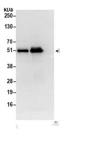 Immunoprecipitation:CCDC97 AntibodyNBP3-30000] -Detection of human CCDC97 by western blot of immunoprecipitates. Samples: Whole cell lysate (0.5 or 1.0 mg per IP reaction; 20% of IP loaded) from 293T cells prepared using NETN lysis buffer. Antibodies: Affinity purified rabbit anti-CCDC97 antibody NBP3-30000 (lot NBP3-30000-1) used for IP at 6 µg per reaction. CCDC97 was also immunoprecipitated by rabbit anti-CCDC97 antibody BL18192. For blotting immunoprecipitated CCDC97, NBP3-30000 was used at 1 µg/ml. Detection: Chemiluminescence with an exposure time of 30 seconds.