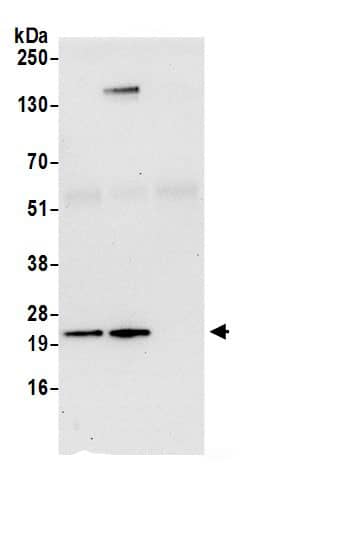 Immunoprecipitation:Synaptobrevin homolog YKT6 AntibodyNBP3-30002] -Detection of human YKT6 by western blot of immunoprecipitates. Samples: Whole cell lysate (0.5 or 1.0 mg per IP reaction; 20% of IP loaded) from 293T cells prepared using NETN lysis buffer. Antibodies: Affinity purified rabbit anti-YKT6 antibody NBP3-30002 (lot NBP3-30002-1) used for IP at 6 µg per reaction. YKT6 was also immunoprecipitated by rabbit anti-YKT6.. For blotting immunoprecipitated YKT6, NBP3-30002 was used at 1 µg/ml. Detection: Chemiluminescence with an exposure time of 30 seconds.