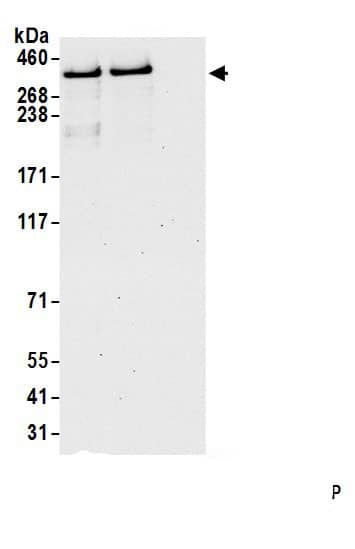Immunoprecipitation:DMXL2 AntibodyNBP3-30003] -Detection of human DMXL2 by western blot of immunoprecipitates. Samples: Whole cell lysate (1.0 mg per IP reaction; 20% of IP loaded) from Jurkat cells prepared using NETN lysis buffer. Antibodies: Affinity purified rabbit anti-DMXL2 antibody (NBP3-30003 lot 1) used for IP at 2 µg per reaction. DMXL2 was also immunoprecipitated by rabbit anti-DMXL2.. For blotting immunoprecipitated DMXL2, NBP3-30003 was used at 0.1 mg/ml. Detection: Chemiluminescence with an exposure time of 30 seconds.