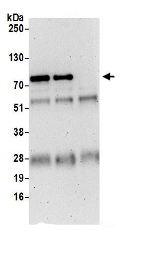 Immunoprecipitation:LZTS1 AntibodyNBP3-30005] -Detection of human LZTS1 by western blot of immunoprecipitates. Samples: Whole cell lysate (0.5 or 1.0 mg per IP reaction; 20% of IP loaded) from Jurkat cells prepared using NETN lysis buffer. Antibodies: Affinity purified rabbit anti-LZTS1 antibody NBP3-30005 (lot NBP3-30005-1) used for IP at 6 µg per reaction. LZTS1 was also immunoprecipitated by rabbit anti-LZTS1 antibody BL19725. For blotting immunoprecipitated LZTS1, NBP3-30005 was used at 0.4 µg/ml. Detection: Chemiluminescence with an exposure time of 3 minutes.