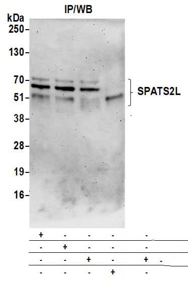 Immunoprecipitation:[NBP3-30006]-Detection of human SPATS2L by western blot of immunoprecipitates. Samples: Whole cell lysate from 293T cells prepared using NETN lysis buffer. Antibodies: Affinity purified rabbit anti-SPATS2L antibody used for IP at 6 µg per reaction. SPATS2L was also immunoprecipitated by rabbit anti-SPATS2L antibodies and. For blotting immunoprecipitated SPATS2L, was used at 0. 1 µg/ml. Detection: Chemiluminescence with an exposure time of 3 minutes.