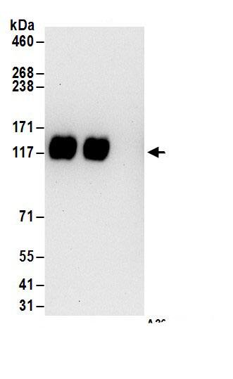 Immunoprecipitation:ZNF828 AntibodyNBP3-30007] -Detection of human CHAMP1 by western blot of immunoprecipitates. Samples: Whole cell lysate (1 mg for IP; 20% of IP loaded) from 293T cells. Antibodies: Affinity purified rabbit anti-CHAMP1 antibody NBP3-30007 (lot NBP3-30007-1) used for IP at 6 µg/mg lysate. CHAMP1 was also immunoprecipitated by rabbit anti-CHAMP1.. For blotting immunoprecipitated CHAMP1, NBP3-30007 was used at 1 µg/ml. Detection: Chemiluminescence with an exposure time of 30 seconds.