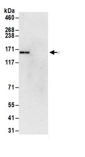 Immunoprecipitation:PURL AntibodyNBP3-30008] -Detection of human PFAS by western blot of immunoprecipitates. Samples: Whole cell lysate (1 mg for IP; 20% of IP loaded) from Jurkat cells. Antibodies: Affinity purified rabbit anti-PFAS antibody NBP3-30008 (lot NBP3-30008-1) used for IP at 6 µg/mg lysate. For blotting immunoprecipitated PFAS, NBP3-30008 was used at 1 µg/ml. Detection: Chemiluminescence with an exposure time of 3 minutes.