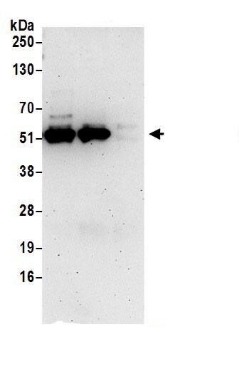 Immunoprecipitation:MPP1 AntibodyNBP3-30009] -Detection of human MPP1/P55 by western blot of immunoprecipitates. Samples: Whole cell lysate (1 mg for IP; 20% of IP loaded) prepared using RIPA buffer from Jurkat cells. Antibodies: Affinity purified rabbit anti-MPP1/P55 antibody NBP3-30009 (lot NBP3-30009-1) used for IP at 6 µg per reaction. MPP1/P55 was also immunoprecipitated by rabbit anti-MPP1/P55 antibody BL16529. For blotting immunoprecipitated MPP1/P55, NBP3-30009 was used at 1 µg/ml. Detection: Chemiluminescence with an exposure time of 3 minutes.