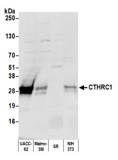 Western Blot:[NBP3-30010]-Detection of human and mouse CTHRC1 by western blot. Samples: Whole cell lysate from UACC-62, Malme-3M, SR, and NIH 3T3 cells prepared using NETN lysis buffer. Antibody: Affinity purified Rabbit anti-CTHRC1 antibody used for WB at 0. 04 mg/ml. Detection: Chemiluminescence with an exposure time of 10 seconds.