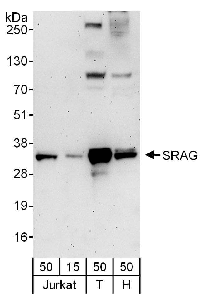 Western Blot:[NBP3-30011]-Detection of human SRAG by western blot. Samples: Whole cell lysate from Jurkat , HEK293T and HeLa cells. Antibody: Affinity purified rabbit anti-SRAG antibody used for WB at 0. 1 µg/ml. Detection: Chemiluminescence with an exposure time of 3 minutes.