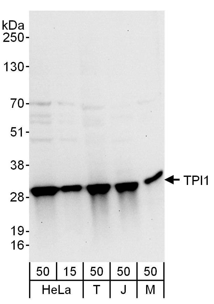 Western Blot:[NBP3-30012]-Detection of human and mouse TPI1 by western blot. Samples: Whole cell lysate from HeLa , HEK293T , Jurkat and mouse NIH 3T3 cells. Antibodies: Affinity purified rabbit anti-TPI1 antibody used for WB at 0. 1 µg/ml. Detection: Chemiluminescence with an exposure time of 10 seconds.