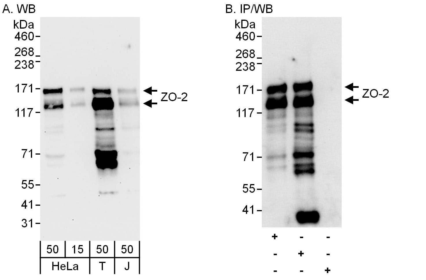 Western Blot:[NBP3-30020]-Detection of human ZO-2 by western blot and immunoprecipitation. Samples: Whole cell lysate from HeLa , HEK293T and Jurkat cells. Antibodies: Affinity purified rabbit anti-ZO-2 antibody used for WB at 0. 1 µg/ml and 1 µg/ml and used for IP at 6 µg/mg lysate. ZO-2 was also immunoprecipitated by rabbit anti-ZO-2 antibody , which recognizes an upstream epitope. Detection: Chemiluminescence with exposure times of 30 seconds and 10 seconds.