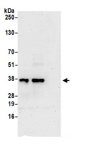 Immunoprecipitation:SUCLG1 AntibodyNBP3-30024] -Detection of human SUCLG1 by western blot of immunoprecipitates. Samples: Whole cell lysate (0.5 or 1.0 mg per IP reaction; 20% of IP loaded) from 293T cells prepared using NETN lysis buffer. Antibodies: Affinity purified rabbit anti-SUCLG1 antibody NBP3-30024 (lot NBP3-30024-1) used for IP at 6 µg per reaction. SUCLG1 was also immunoprecipitated by rabbit anti-SUCLG1 antibody BL20894. For blotting immunoprecipitated SUCLG1, NBP3-30024 was used at 1 µg/ml. Detection: Chemiluminescence with an exposure time of 30 seconds.