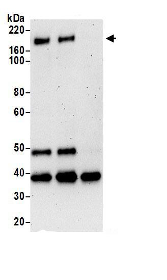 Immunoprecipitation CELSR1 Antibody