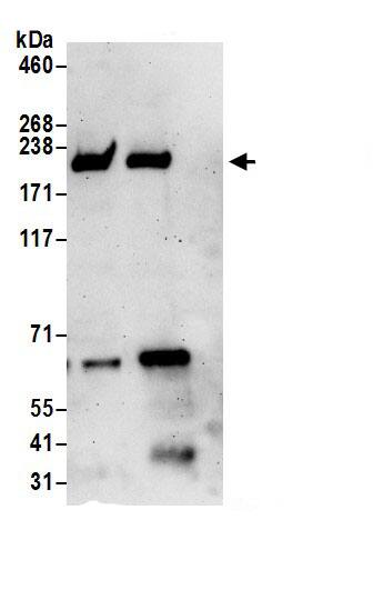 Immunoprecipitation:RhoGAP AntibodyNBP3-30027] -Detection of human ARHGAP5 by western blot of immunoprecipitates. Samples: Whole cell lysate (0.5 or 1.0 mg per IP reaction; 20% of IP loaded) from 293T cells prepared using NETN lysis buffer. Antibodies: Affinity purified rabbit anti-ARHGAP5 antibody NBP3-30027 (lot NBP3-30027-1) used for IP at 6 µg per reaction. ARHGAP5 was also immunoprecipitated by rabbit anti-ARHGAP5.. For blotting immunoprecipitated ARHGAP5, NBP3-30027 was used at 1 µg/ml. Detection: Chemiluminescence with an exposure time of 3 minutes.