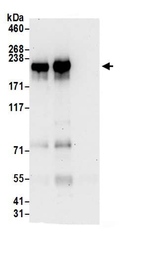 Immunoprecipitation:NFAT5 AntibodyNBP3-30029] -Detection of human NFAT5 by western blot of immunoprecipitates. Samples: Whole cell lysate (0.5 or 1.0 mg per IP reaction; 20% of IP loaded) from HeLa cells prepared using NETN lysis buffer. Antibodies: Affinity purified rabbit anti-NFAT5 antibody NBP3-30029 (lot NBP3-30029-1) used for IP at 6 µg per reaction. NFAT5 was also immunoprecipitated by rabbit anti-NFAT5.. For blotting immunoprecipitated NFAT5, NBP3-30029 was used at 0.4 µg/ml. Detection: Chemiluminescence with an exposure time of 30 seconds.