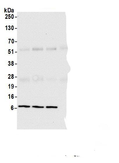 Immunoprecipitation:VMA21 AntibodyNBP3-30030] -Detection of human VMA21 by western blot of immunoprecipitates. Samples: Whole cell lysate (1.0 mg per IP reaction; 10% of IP loaded) from HEK293T cells prepared using NETN lysis buffer. Antibodies: Affinity purified rabbit anti-VMA21 antibody (NBP3-30030 lot 2) used for IP at 2 µg per reaction. VMA21 was also immunoprecipitated by a previous lot of this antibody (NBP3-30030 lot 1) and another.inst a different epitope of VMA21. For blotting immunoprecipitated VMA21, NBP3-30030 was used at 0.1 mg/ml. Detection: Chemiluminescence with an exposure time of 10 seconds.