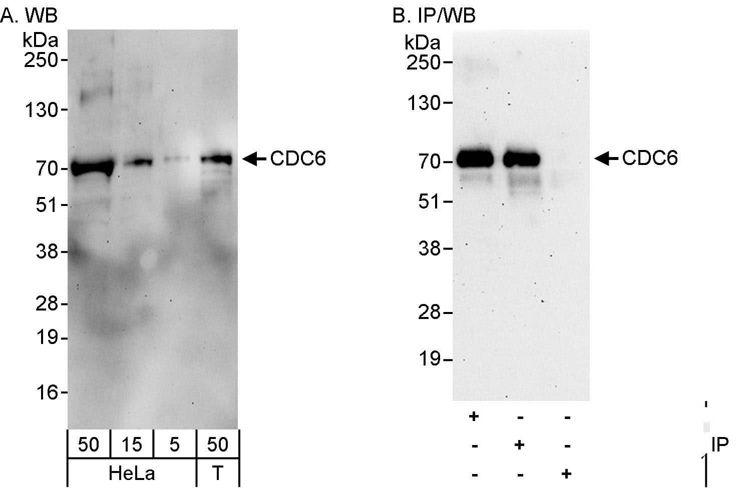 Western Blot:[NBP3-30031]-Detection of human CDC6 by western blot and immunoprecipitation. Samples: Whole cell lysate from HeLa and HEK293T cells. Antibodies: Affinity purified rabbit anti-CDC6 antibody used for WB at 0. 4 µg/ml and 1 µg/ml and used for IP at 3 µg/mg lysate. CDC6 was also immunoprecipitated by rabbit anti-CDC6 antibody , which recognizes an upstream epitope. Detection: Chemiluminescence with exposure times of 3 minutes.